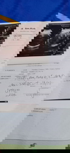 Hpl di USG atau di aplikasi tap