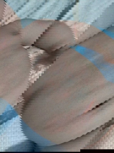 Help! What rashes is this?