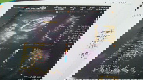 Assalamualaikum bund