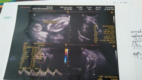 Assalamualaikum bund