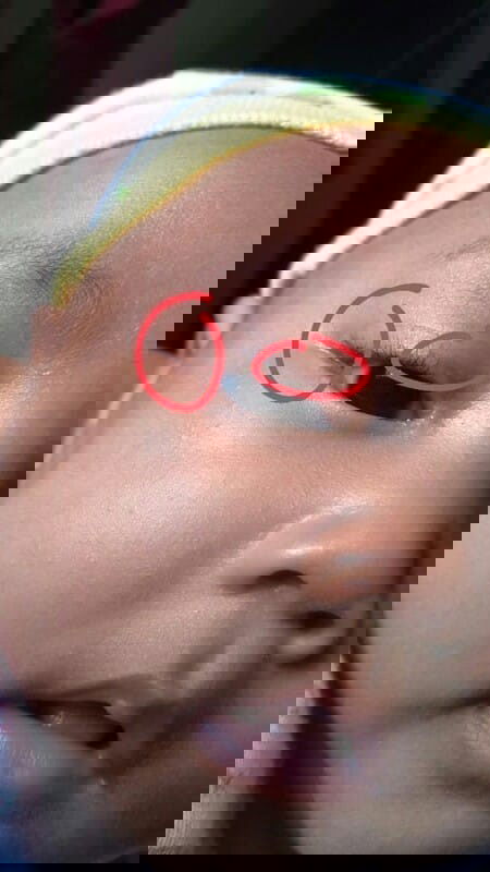 Putih-putih dikelopak mata