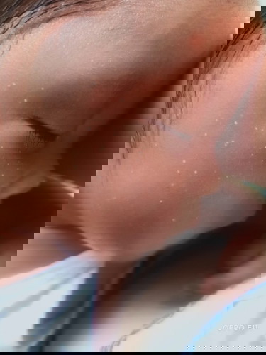 Pano po kya mawla butlig2 sa mukha n baby