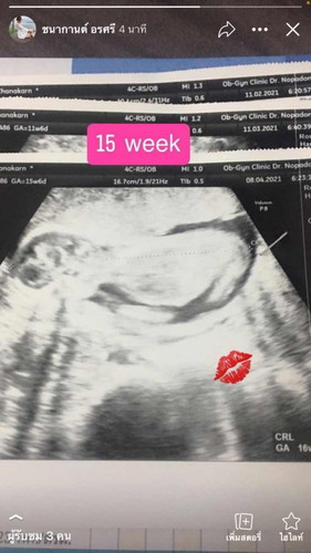 15+6 w ไม่ยอมให้แม่ดูเพศเลยไอ้ตัวจิ๋ว🥰🥰