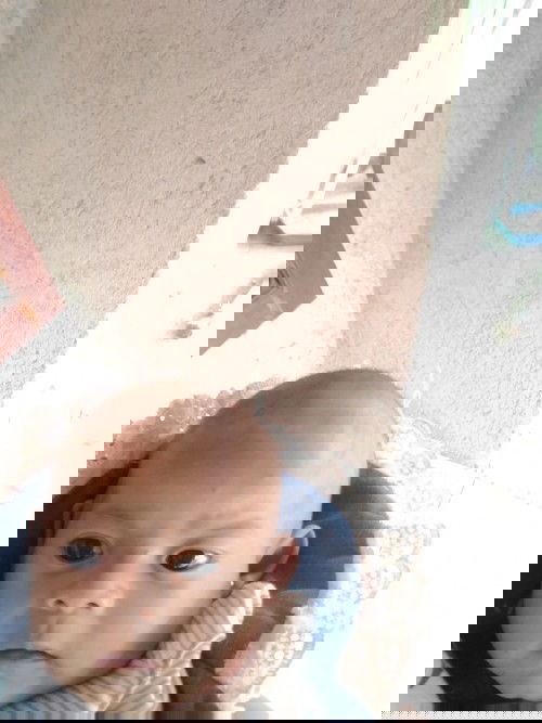 Kenapa ya ubun ubun bayi nya agak cembung dan kalo di lihat seperti tidak berdenyut,tapi