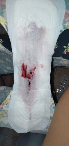 implantation bleeding po ba to? March 14 nag start on and off mens ko. nag PT on march 20 positive