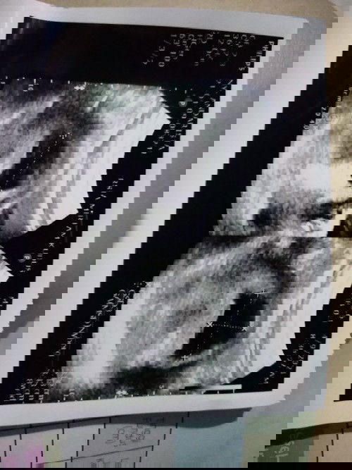 Janin belum terlihat