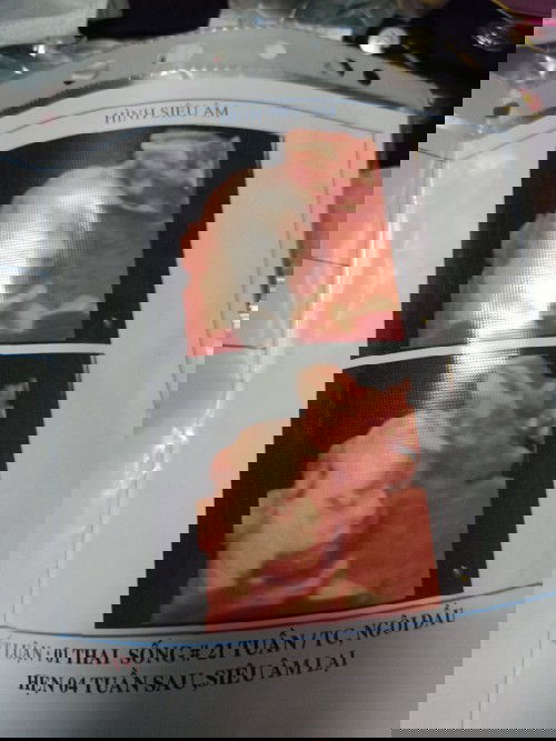 Lần đầu làm mẹ