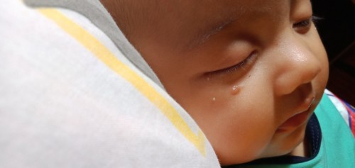 Kulit bayi seperti berair