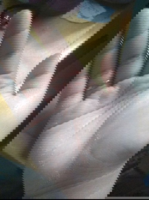 Kulit yang seakan mengelupas