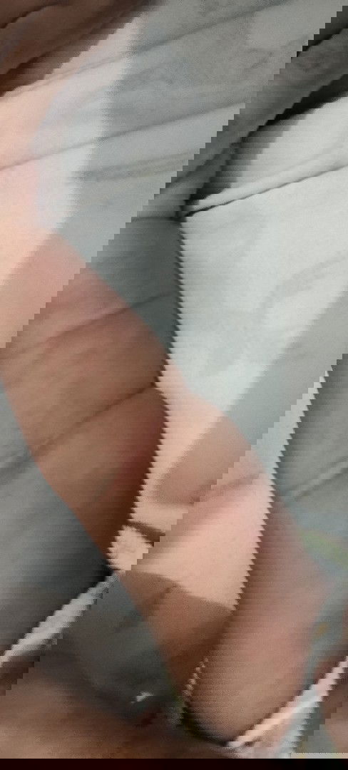 Bentol merah pada bayi