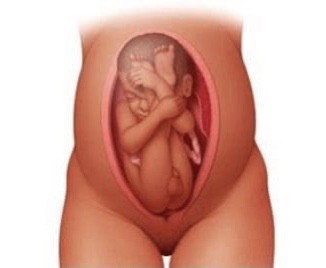 สอบถามค่ะ ลูกของแม่ๆกลับหัวกันตอนกี่วีคคะ