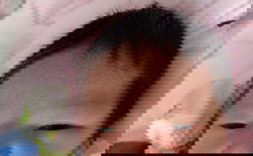 เด็กแรกเกิด 7วัน เป็นผด