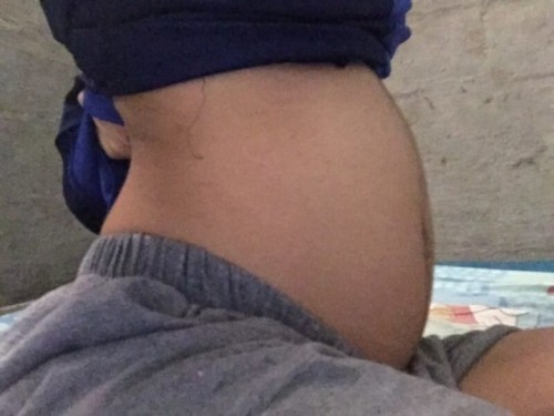แพ้ท้องน้ําหนักลด ท้องแรก 18w 2d มีใครท้องเล็กแบบนี้บ้างค่ะ?