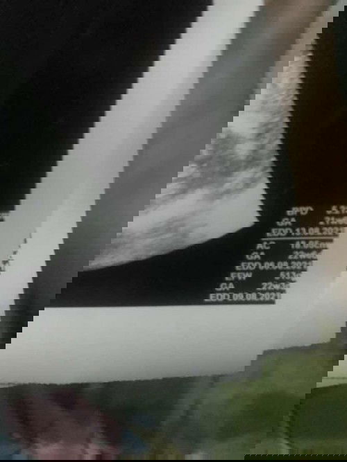 Panjang janin usia 5 bln