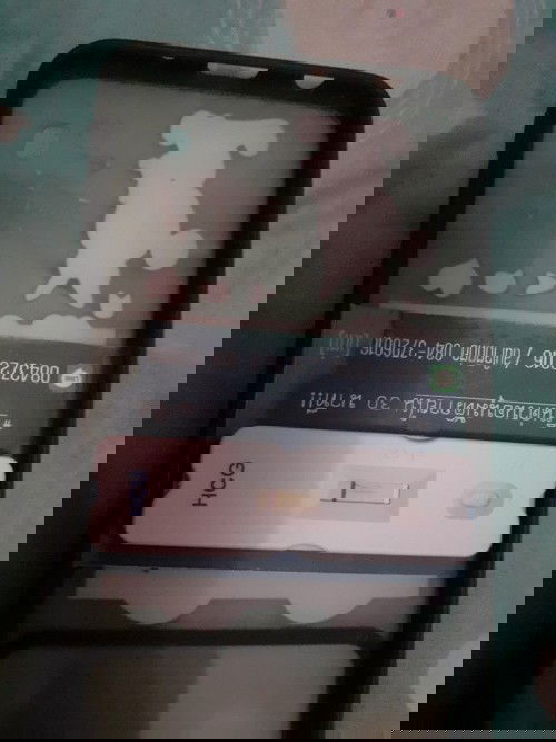 ประจำเดือนขาด