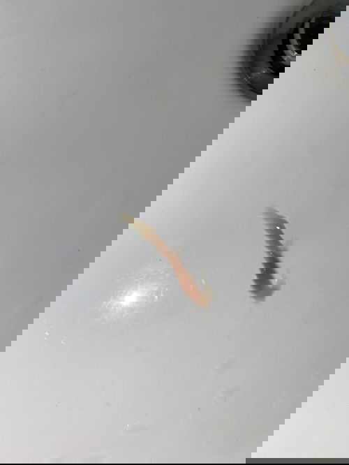 Mucus Plug: Sharing Pengalaman.