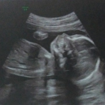 ป๊าหมอบอกน้องนอนน่ารักมาก