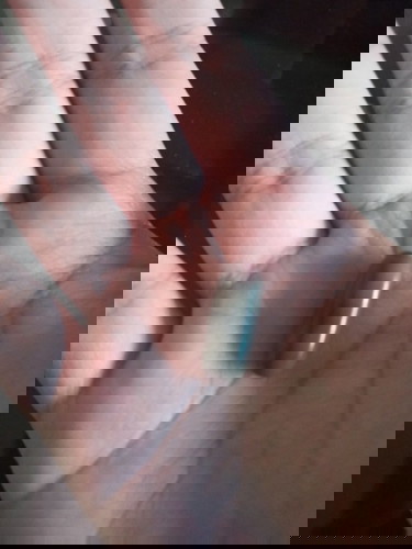 Iba ang kulay ng vitamins or may discoloration