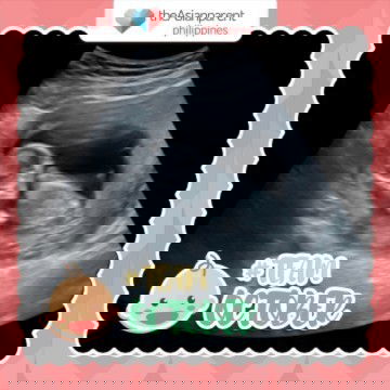 13 week 5 hari alhamdulillah