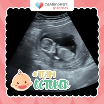 13 week 5 hari alhamdulillah