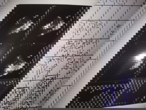 33mgg masih sungsang