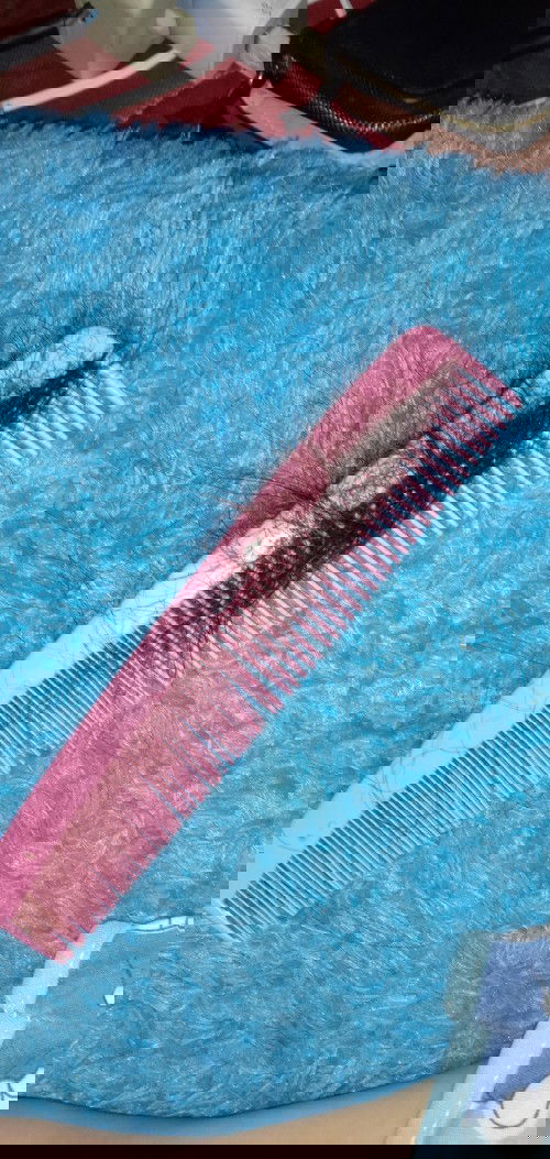 rambut rontok parah setelah melahirkan