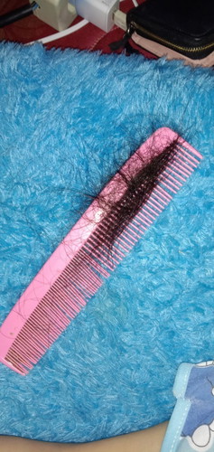 rambut rontok parah setelah melahirkan