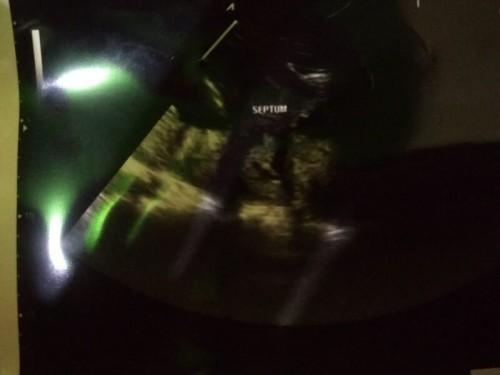 Ada yang tau nggak ?