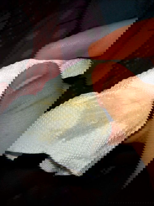 มันเป็นตกขาวหรือมูกเลือดค่ะ