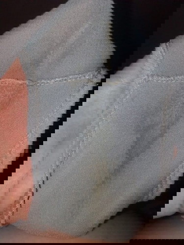 ท้องได้35wคะเป็นเเบบนี้คืออะไรอะ