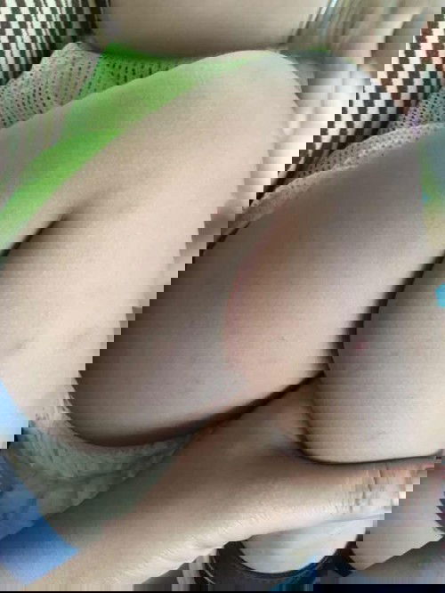 น้องขาลาย แก้ยังไงได้บ้าง