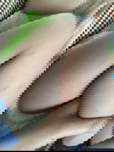 น้องขาลาย แก้ยังไงได้บ้าง