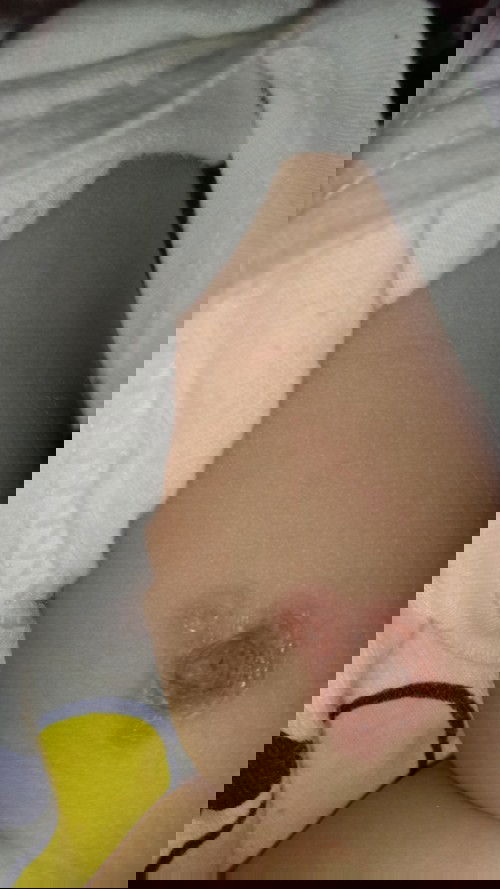 Kata bidan penyakit kulit biasa