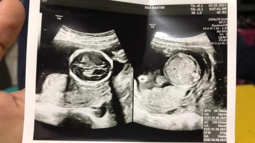 Drama Ngidam Anak Pertama