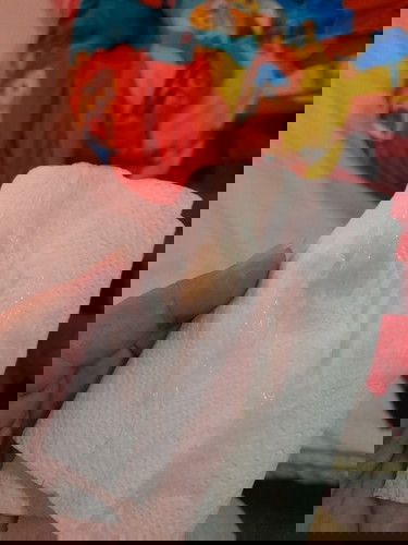 มูกเหลืองแบบนี้ใช่มั้ยคะ