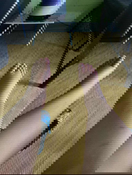 เท่ายังบวมอยู่เลย