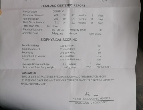 Medyo excited lang po, ano po kayang possible gender. Im 21weeks pero not seen pdin gender.
