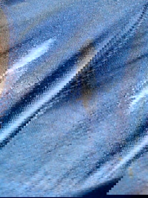 Saan nakukuha ang preeclampsia