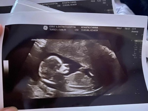 อัลตราซาวด์ของลูกรัก