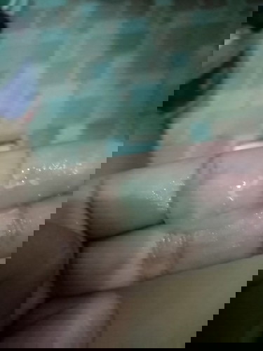 White Discharge