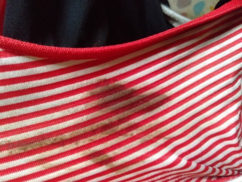 อยากสอบถามค่ะแม่คือมีตกขาวสีนี้ออกมาหลังประจำเดือนหมดไปแล้วคือเราฝังเข็มยาคุมจะ1ปีแล้ว