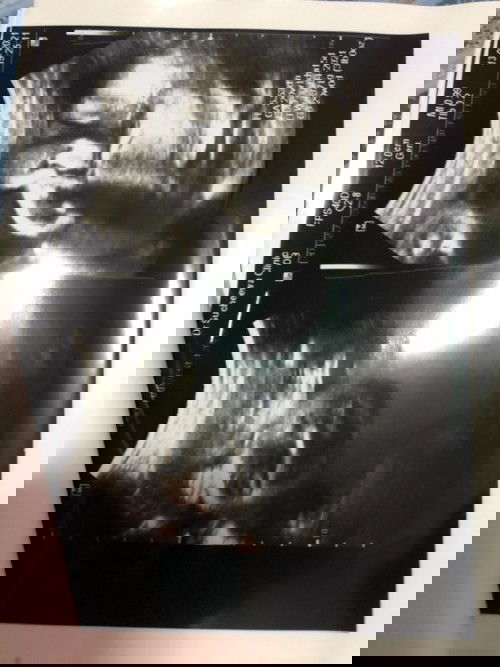 ทีมเมษาแม่คนไหนผ่าคลอดบ้างคะ👍🏻