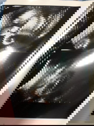 ทีมเมษาแม่คนไหนผ่าคลอดบ้างคะ👍🏻