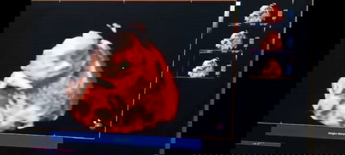 Ibu di curigai ada diabetes