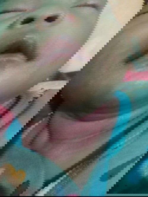 Leher berlipat jadi merah