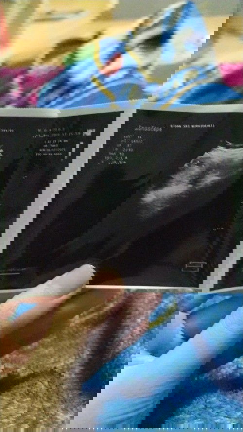 USG 9 minggu belum ada janin nya