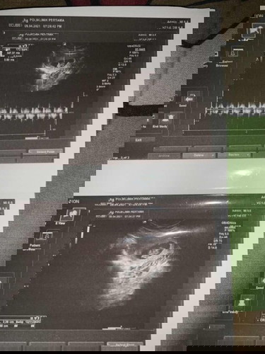 My Baby 9 weeks ❤️