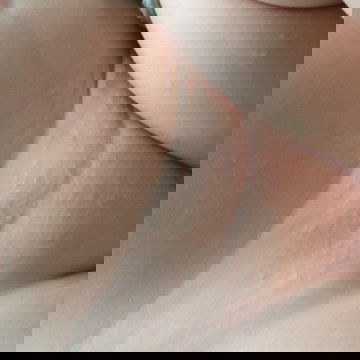 ลูกเป็นผื่นแบบนี้ใช้ครีมอะไรดีคะใช้ครีมตัวนี้แล้วไม่หาย