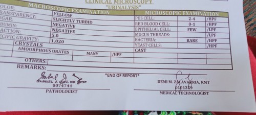 Urinalysis test