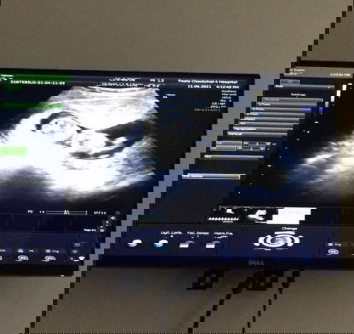 3เดือน มาอวดภาพน้องๆกันนะคะ